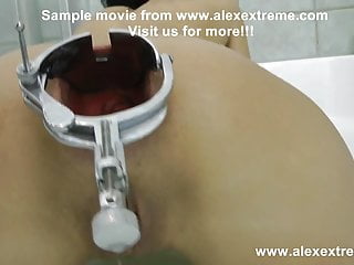 Alexextreme - Anal Fisting, Speculum, Prolapse, Extreme Dildo free video