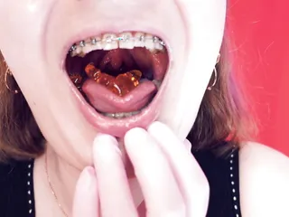 Asmr Eating Jelly Bears With Braces By Arya Grander free video